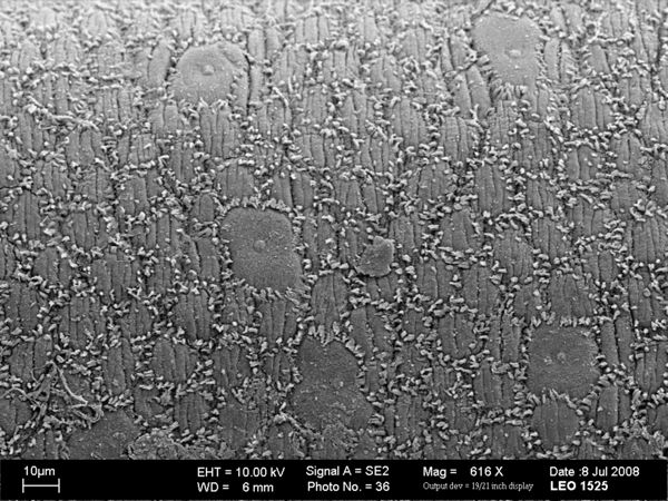 Vorschaubild Parachordodes tolosanus